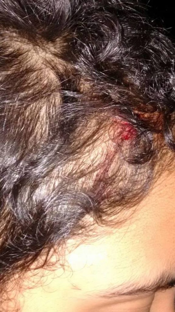 Em junho de 2015, uma menina de 11 anos foi atacada com uma pedrada na cabeça ao sair de um culto de candomblé na Penha, na zona norte do Rio